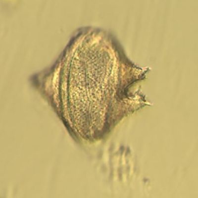 microscopic photo of Protoperidinium leonis